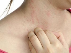 مرض السكري - 5 أعراض تشير الى الإصابة بمرض السكري لا يعرفها الكثيرون