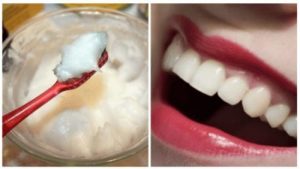 ودع مشاكل الفم والأسنان مع هذا العلاج الطبيعي الفعال!