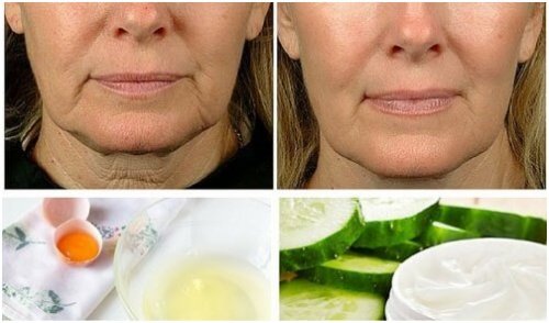 ترهلات الوجه – 5 علاجات منزلية فعالة لمكافحة هذه الترهلات المزعجة