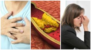 كولسترول الدم - 10 علامات تحذيرية تشير إلى ارتفاع نسبة الكولسترول