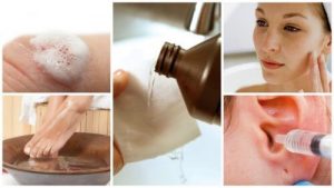 بيروكسيد الهيدروجين - 9 وصفات علاجية منزلية يجب عليك معرفتها