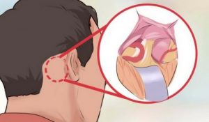 5 معلومات حول ألم العصب الثلاثي التوائم، الألم الأسوأ في العالم