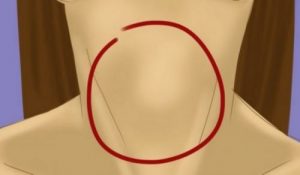 القصور الدرقي - اكتشف 10 أطعمة رائعة لتخفيف أعراض الحالة