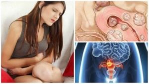 أورام الرحم الليفية - 5 حقائق مهمة يجب على كل امرأة أن تعرفها