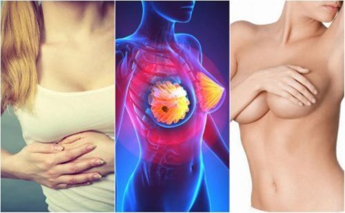 سرطان الثدي – 9 من الأعراض التي يجب على كل امرأة معرفتها