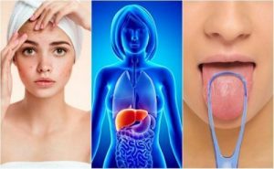 سموم الكبد – 7 علامات تحذيرية يرسلها الكبد عند زيادة السموم فيه