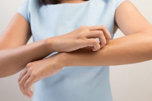 مرض القوباء - أعراضه وطرق تشخيصه، وأمور يجب أن تكون على دراية بها