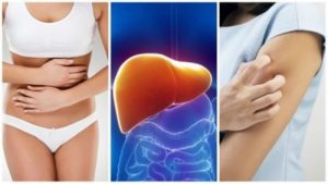 سموم الكبد - 8 أعراض تظهر عليك عندما يكون كبدك مثقلًا بها