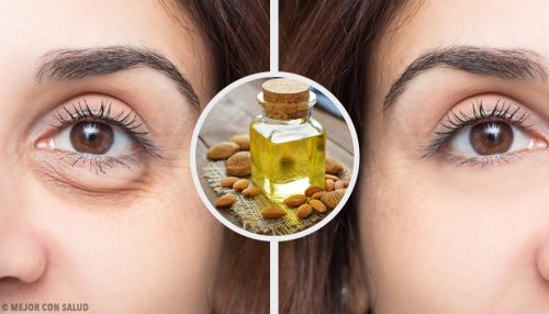 4 أقنعة بسيطة تساعدك على إزالة الهالات السوداء