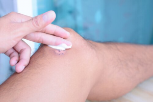 معالجة الجروح