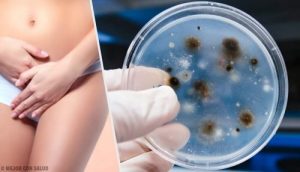 العدوى والالتهابات المهبلية: اكتشفي أنواع الحالة ومسبباتها المختلفة