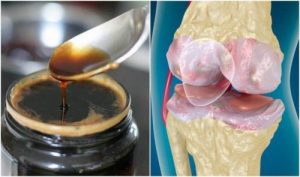 العظام و المفاصل – علاج يساعدك على تعزيز عظامك ومفاصلك