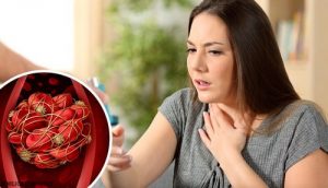 تخثر الدم – اكتشف ثمان علامات مهمة تُنذر بالإصابة بتخثر الدم