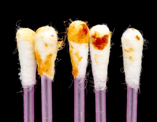 مجموعة من أعواد تنظيف الأذن المستعملة