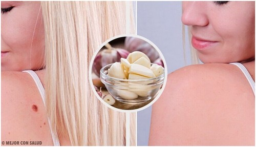 علاج البثور - 8 طرق فعالة وسريعة للتخلص من البثور