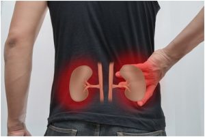 مشاكل الكلى و إحتباس الماء بالجسم