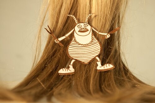 شعر فتاة يعاني من مشكلة حشرة القمل