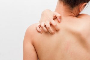 فتاة تعاني من حكة بالجلد بسبب مشاكل الأمعاء