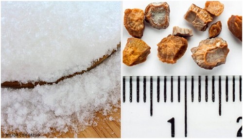 أشكال مختلفة من حصوات الكلى