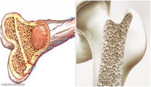هشاشة العظام مع التقدم في العمر وتجاوز سن الأربعين