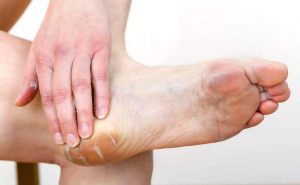 سيدم تقوم بدهان مرطب على منطقة القدم والكعب