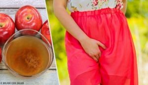 حكة المهبل والحرقان - نصائح ووصفات فعالة لعلاج الحالة