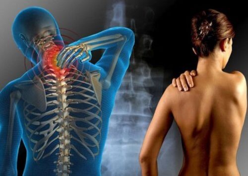 الألم العضلي الليفي – الذي تحتاج إلى معرفته حول هذا المرض