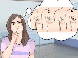 سرطان الثدي - أنواعه وأعراضه ووسائل علاجه المختلفة