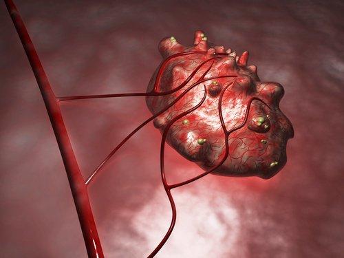 أكياس المبيض