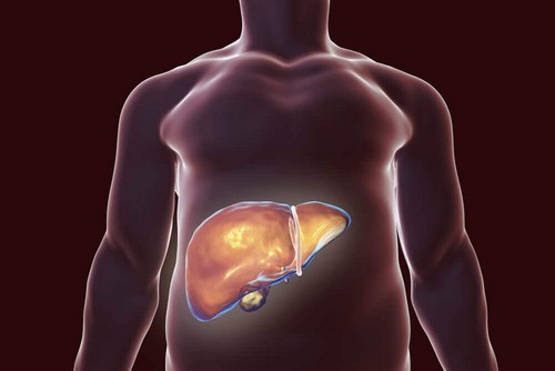 أفضل العلاجات الطبيعية التي تساعد على تخليص كبدك من السموم