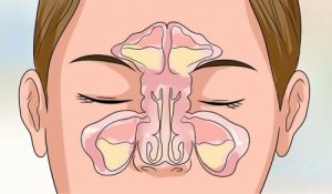 6 نصائح تساعدك على مكافحة انسداد الأنف في غضون دقائق