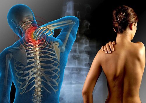 آلام العضل الليفي نتيجة إستهلاك الأغذيؤة التي تحتوي على الجلوتين