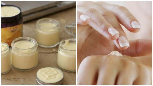 جفاف اليدين – علاج طبيعي ومنزلي فعال لمشكلة جفاف بشرة اليدين