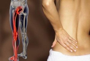 6 تمارين بسيطة للتخلص من آلام الورك