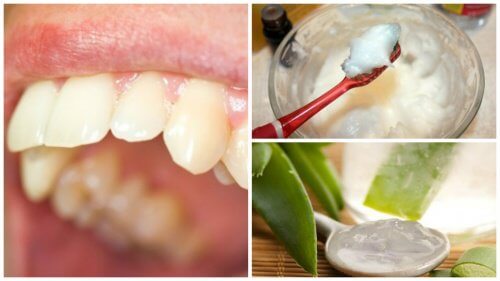 بلاك الأسنان – كافح اللويحات السنية باستخدام هذه العلاجات الطبيعية
