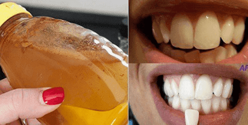 طريقة تبييض الأسنان بمكون طبيعي 100%