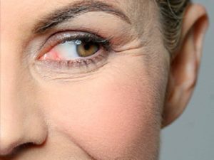 علامات الشيخوخة