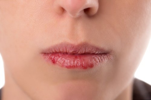 سرطان الفم والبلعوم – هام! أعراض سرطان الفم والبلعوم التي يجب أن تنتبه إليها