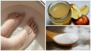 فطريات الأظافر - اقضِ عليها تمامًا بالاستعانة بهذا العلاج الطبيعي