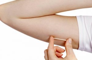 وسائل منع الحمل - كل ما تحتاجين إلى معرفته عن غرسات منع الحمل
