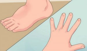 احتباس سوائل الجسم - 5 وسائل بسيطة للتخفيف من احتباس السوائل في الجسم