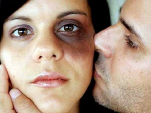 رجل يقبّل امرأة بعد أن تلقت الضرب