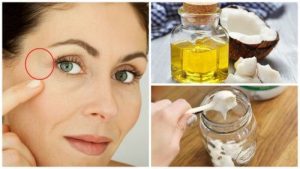 تجاعيد أقدام الغراب - خففها باستخدام هذا الكريم الليلي الطبيعي!