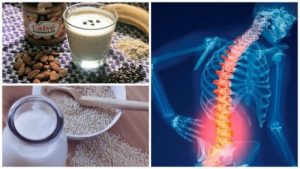 تجنب هشاشة العظام - 6 وسائل طبيعية تستطيع من خلالها مكافحة تخلخل العظم
