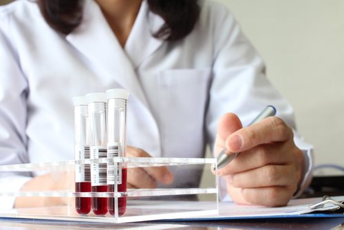 طبيبة أمامها عينات دم
