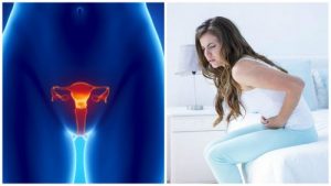 سرطان المبيضين - 7 معلومات مهمة تحتاجين إلى معرفتها