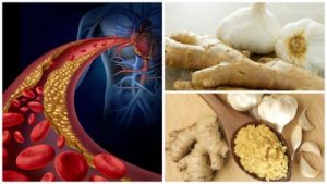 ضغط الدم والكوليسترول - وصفة الزنجبيل والثوم لتخفيف ضغط الدم والكوليسترول