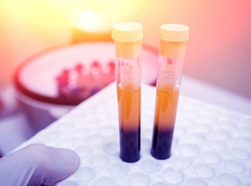 عدد الصفائح الدموية - هل ترغب في زيادته؟ هذه العلاجات الأربعة ستساعدك