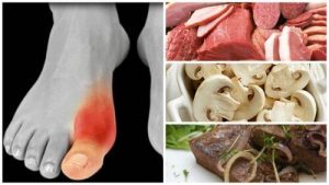 مركبات البيورينات: كل ما تحتاج إلى معرفته
