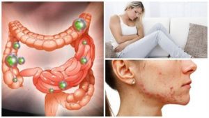البكتيريا المعوية - 6 مشكلات تظهر عند خروجها عن السيطرة